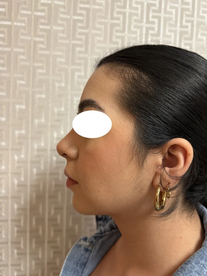 Después, vista de perfil